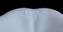 Acanthus_Johnson Bros. (Late Pankhurst & Co.)_Serving Bowl_Embossing_002